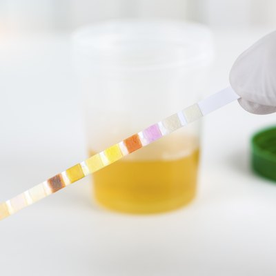 Medical urine test with urine test strips, close up