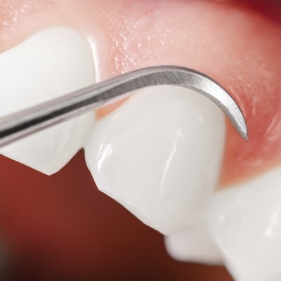 Gums and teeth examination. Close up