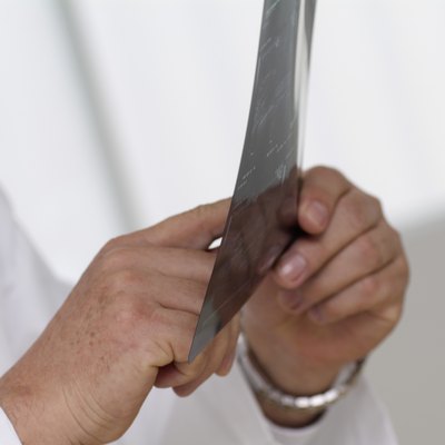Close-up of a doctor reviewing an x-ray film