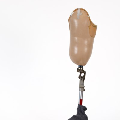 above knee prosthesis
