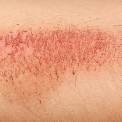 Close up view of nasty wound