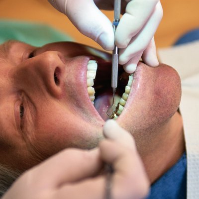 Tooth Cleaning