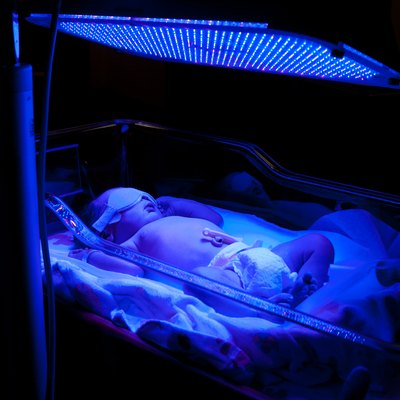 Baby with Phototherapy