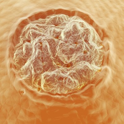 Plantar Wart Up-Close
