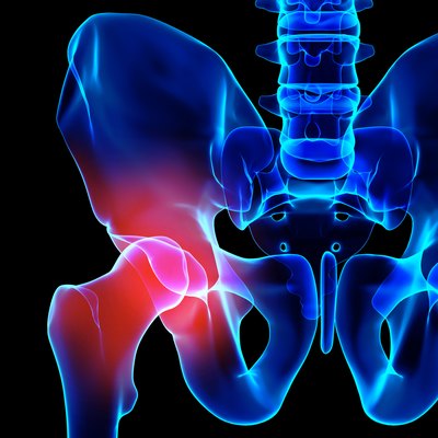 Hip painful skeleton x-ray, 3D illustration.