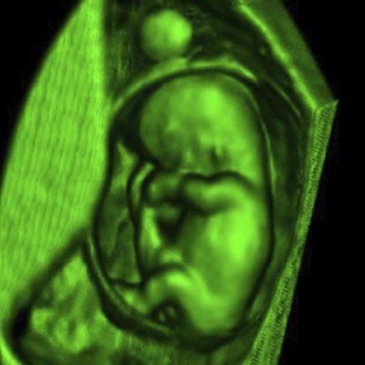 embryo
