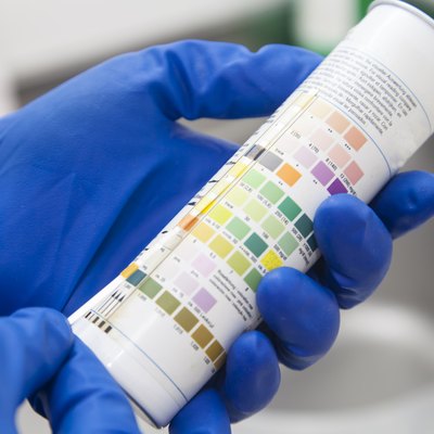 Urine test strips