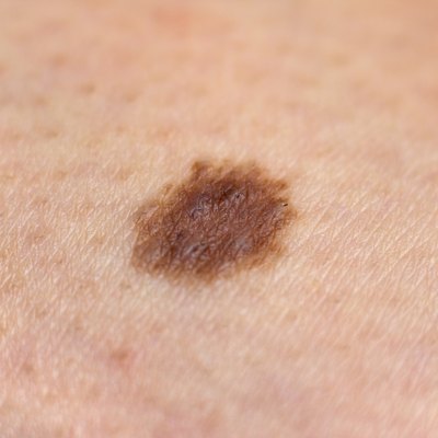 Mole