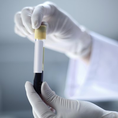 Blood test