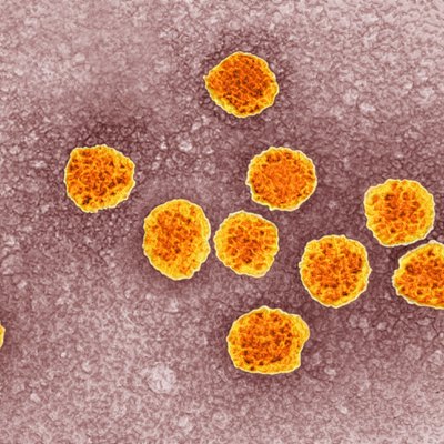 Hepatitis C Virus