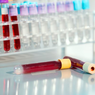 Test tubes