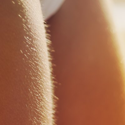 Woman's legs with goosebumps