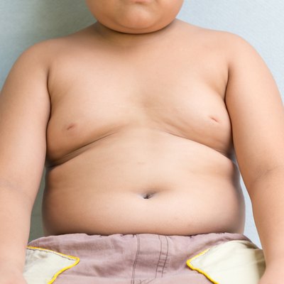 The size of stomach of children with overweight.