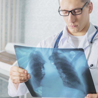 Doctor with x-ray picture