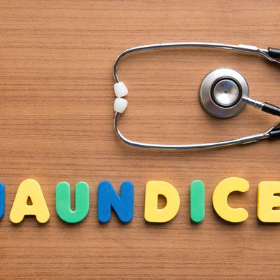 Jaundice