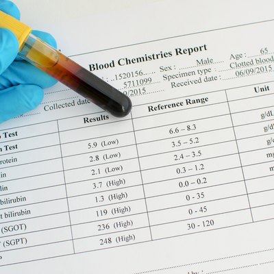Abnormal liver function test result