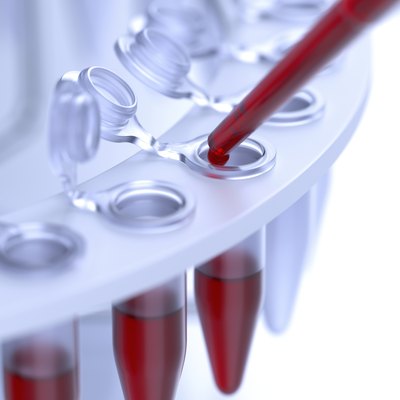 Laboratory blood test
