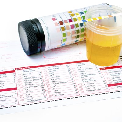 Urine test strips