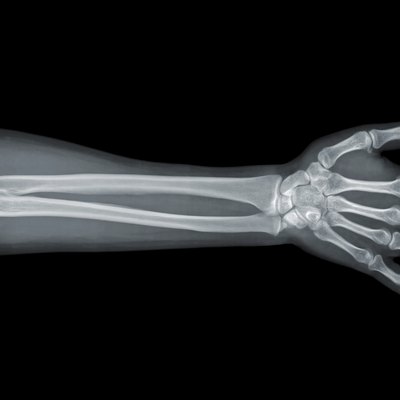 Hand x-ray view