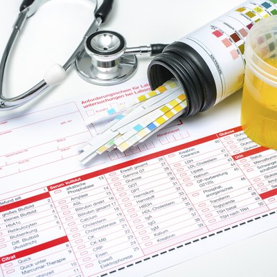 Urine test strips