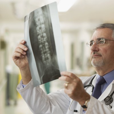 Elderly doctor looking at x-rays