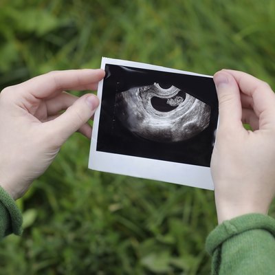 Ultrasound photographs of pregnancy