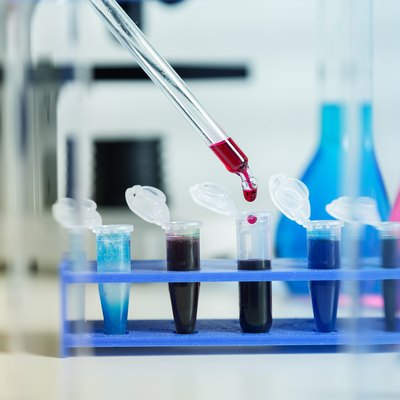 Blood samples for research in microtubes