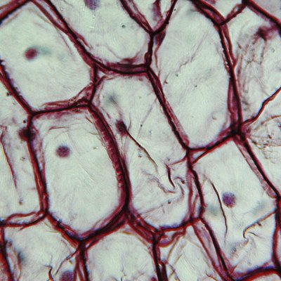 Onion epidermus micrograph
