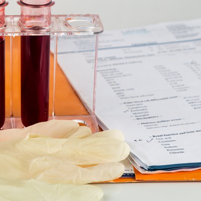 Blood sample in test tubes with health analysis screening report