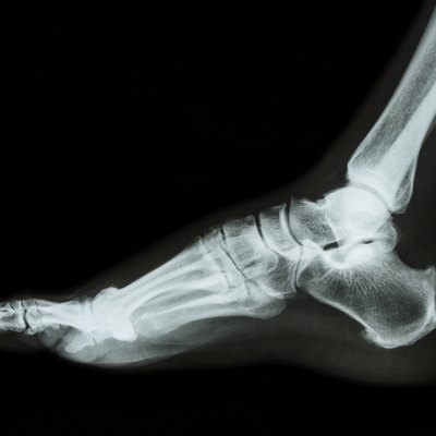 X-ray normal foot lateral