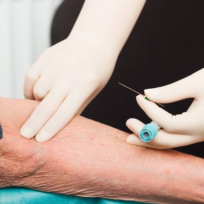 Blood Test