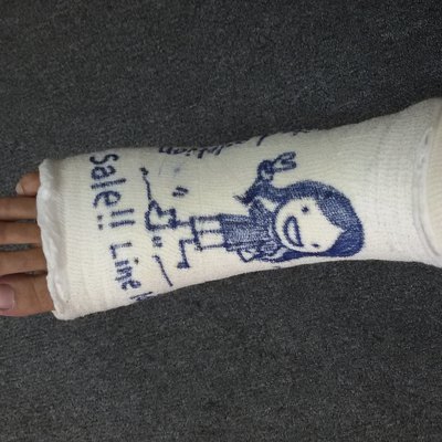 Art on soft splint