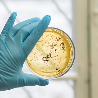 Petri dish with growing bacteria