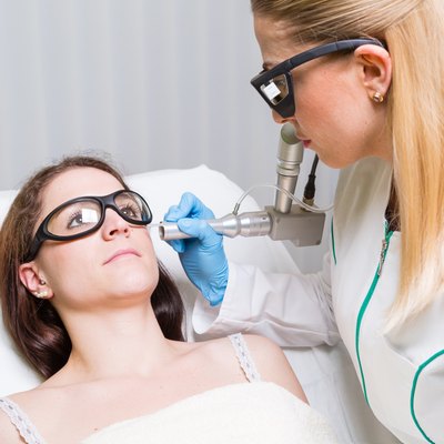 medical laser, face, liver spot