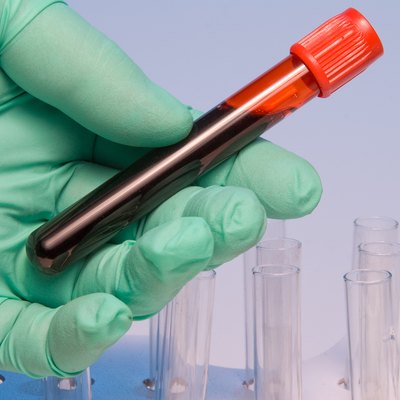 Green gloved hand holding blood sample in test tube