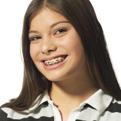 portrait of an ethnic female teenager with braces as she flashes a big grin