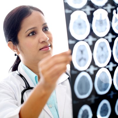Female doctor examining a brain computerized scan