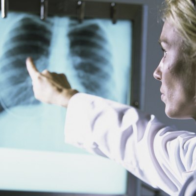 Female doctor pointing at a chest X-ray