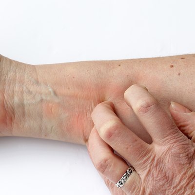 Itchy red skin