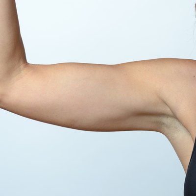 Middle aged woman showing flabby arm