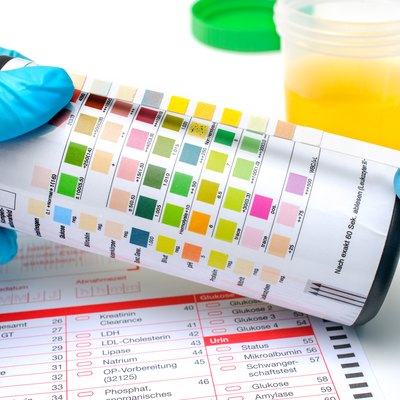 Urine test strips