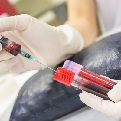 Take a blood on the tube of chemistry laboratory.