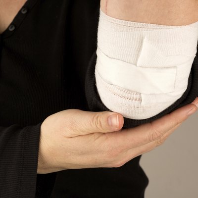 Injured arm