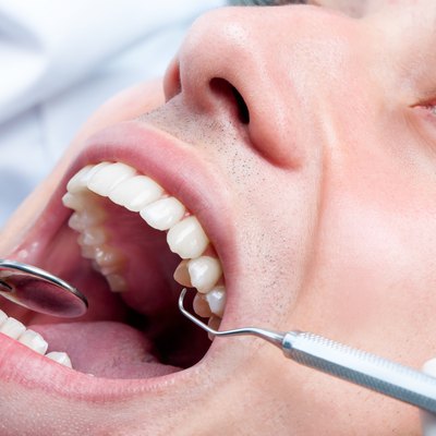 Young man whitening teeth at dentist.