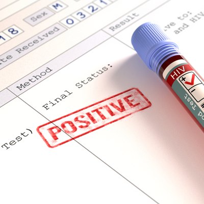 HIV Positive