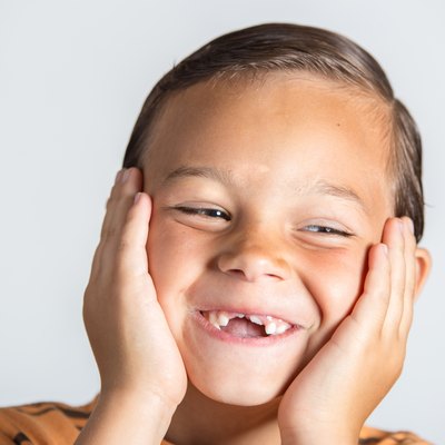 Boy showing missing teeth.