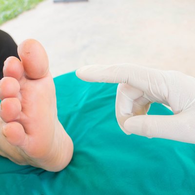 diabatic foot skining neuropathy