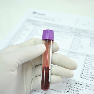 blood tube in hand of scientist