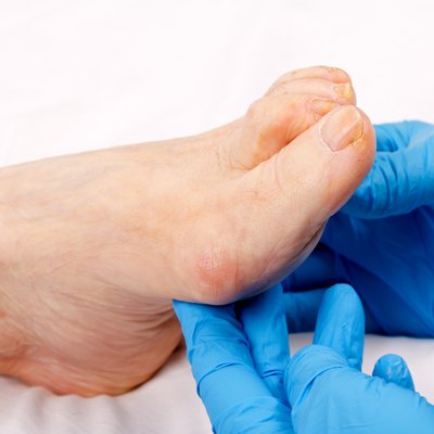 Feet care