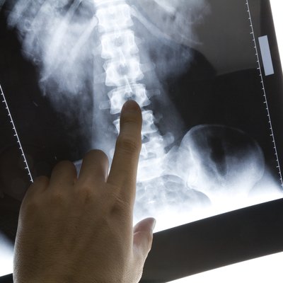 x-ray image